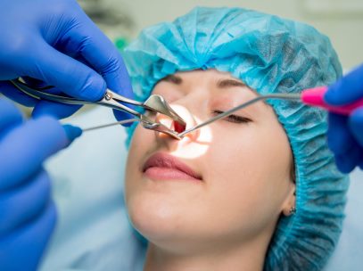 Endoscopic Sinus Surgery 